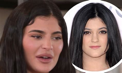 kylie jenner plastic surgery daily mail|Kylie Jenner confirms plastic surgery on 'The Kardashians' .